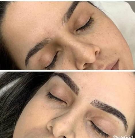 Sobrancelha Micropigmentação