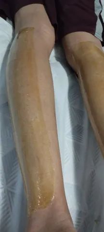 Depilação em domicílio  - Foto 4