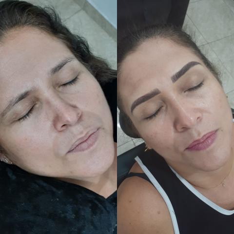 Sobrancelha Micropigmentação - Foto 3