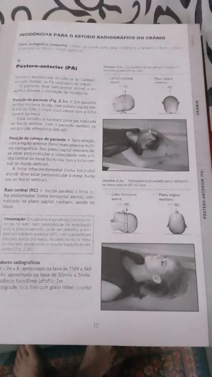 MANUAL DE POSICIONAMENTO RADIOGRÁFICO  - Foto 4
