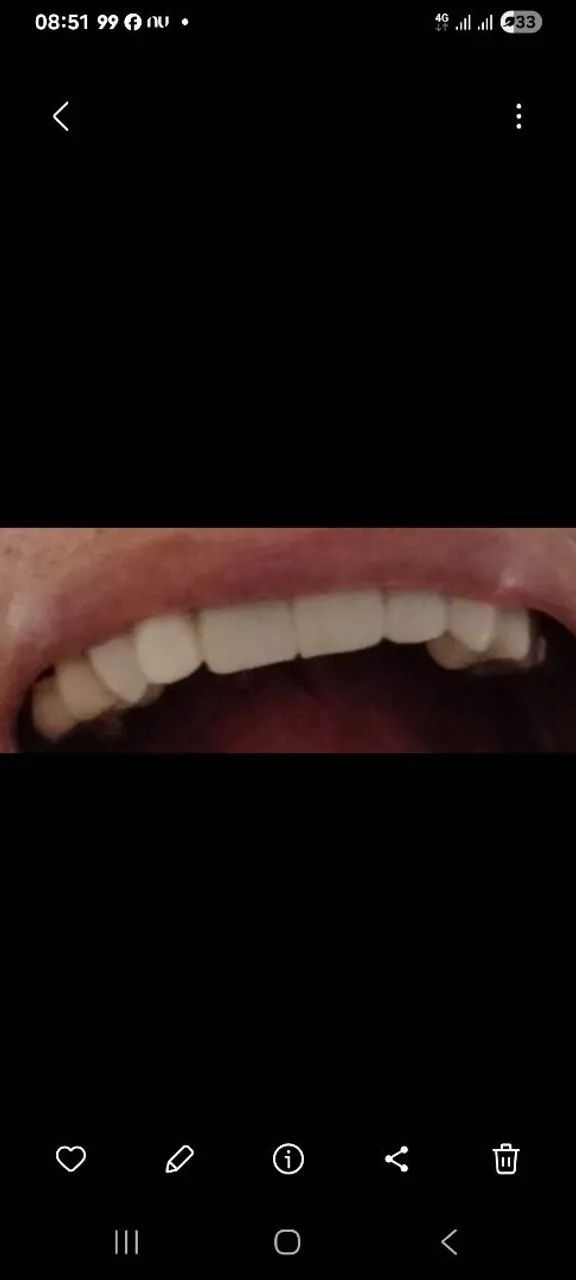 Dentista próximo da Estação de Metrô Eng Rubens Paiva  - Foto 3