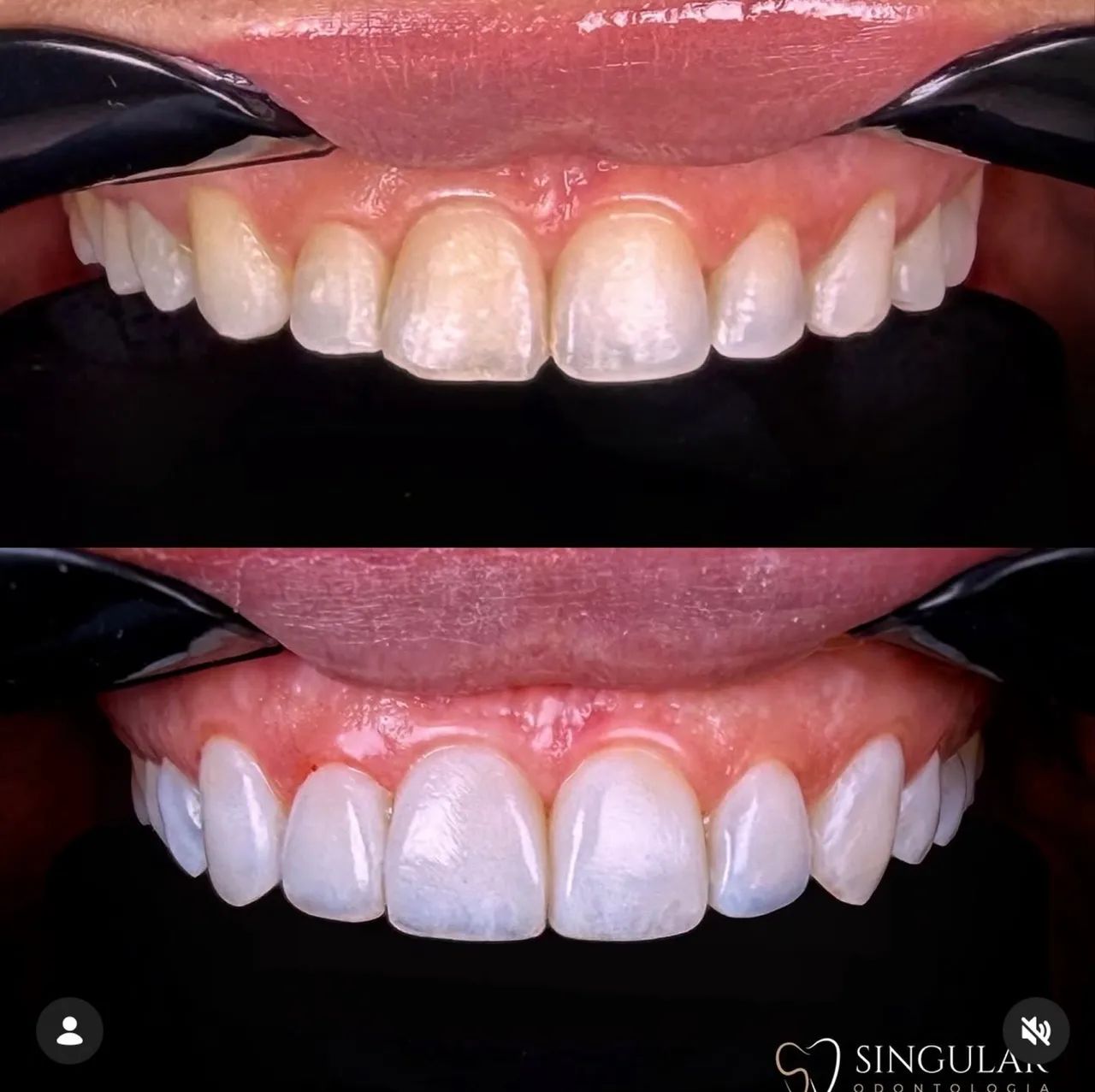 UM SORRISO SAUDÁVEL, BONITO E CUIDADO EM CADA DETALHE.