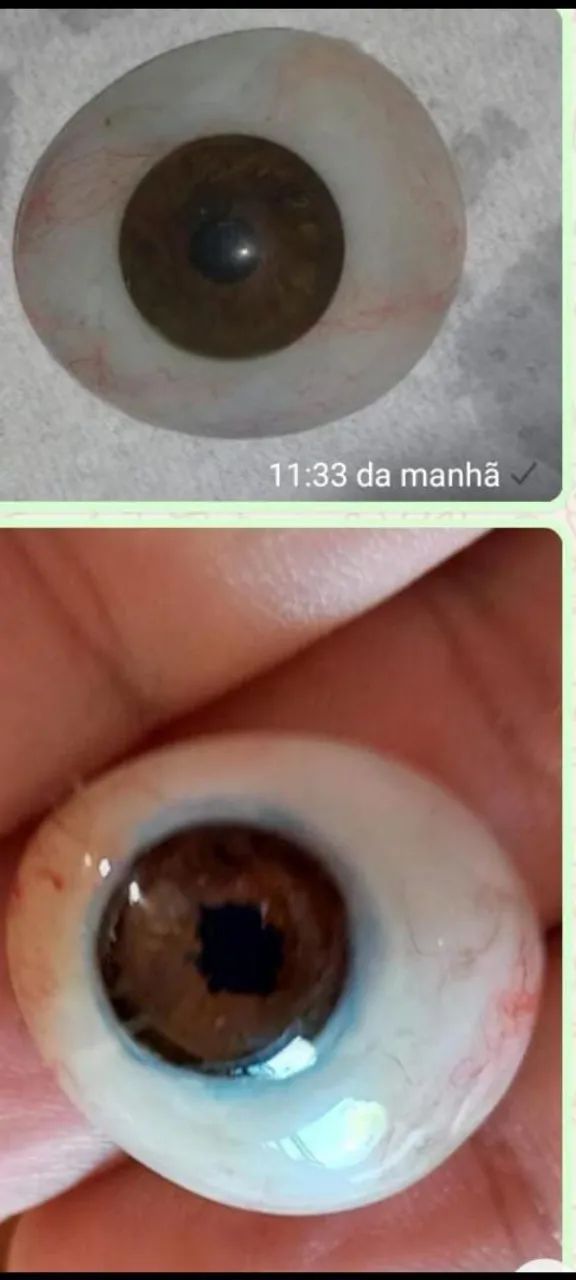 prótese bucomaxilo  - Foto 2