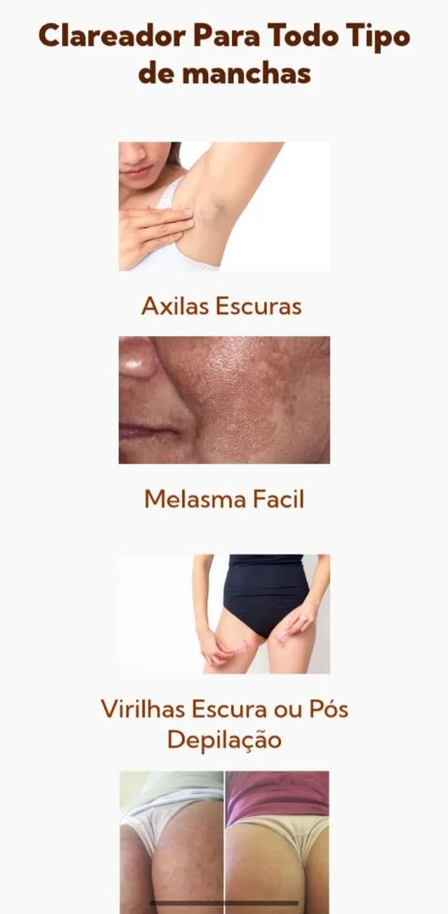 Clareador de manchas $99,00 - Foto 5