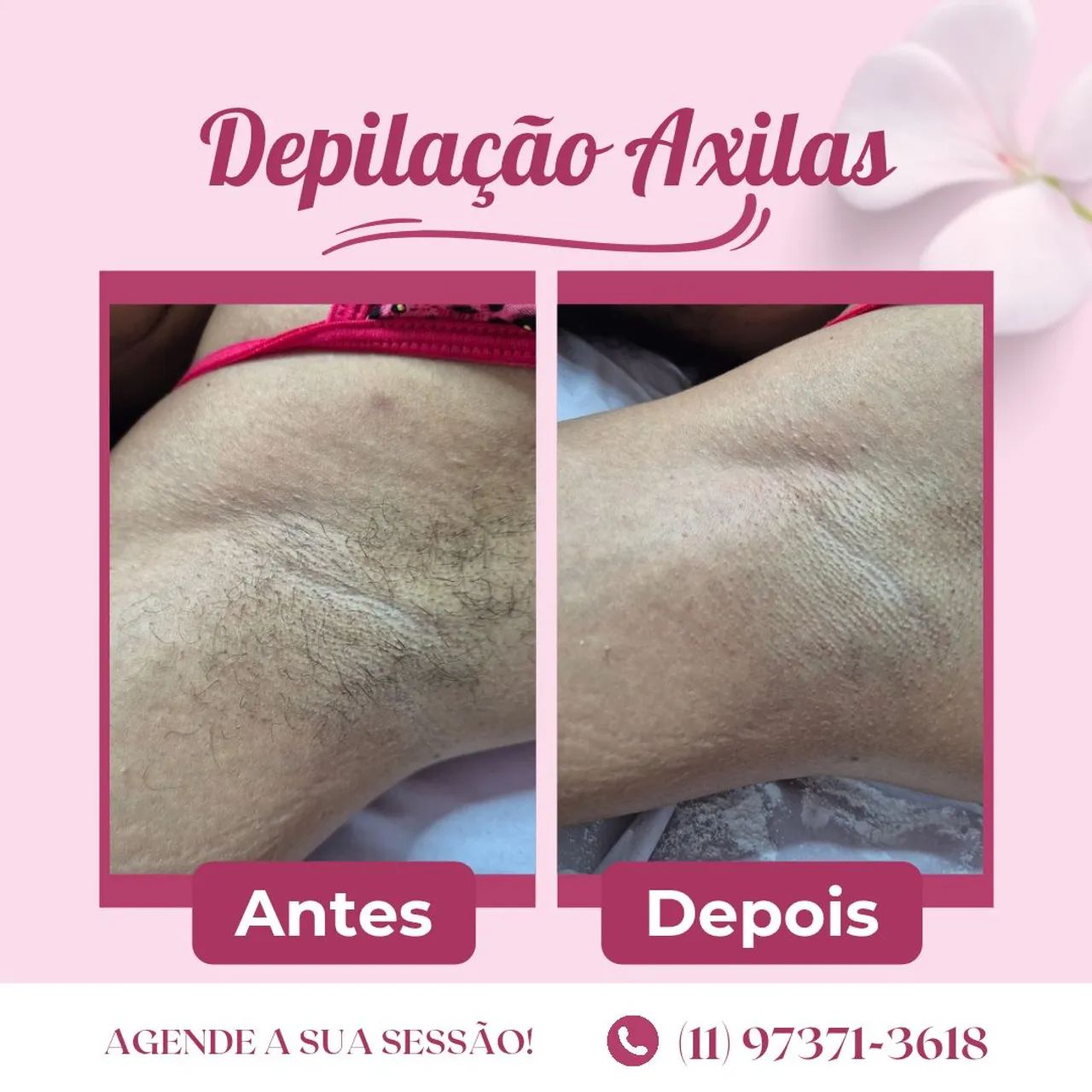 Designer de Sobrancelhas  - Foto 2