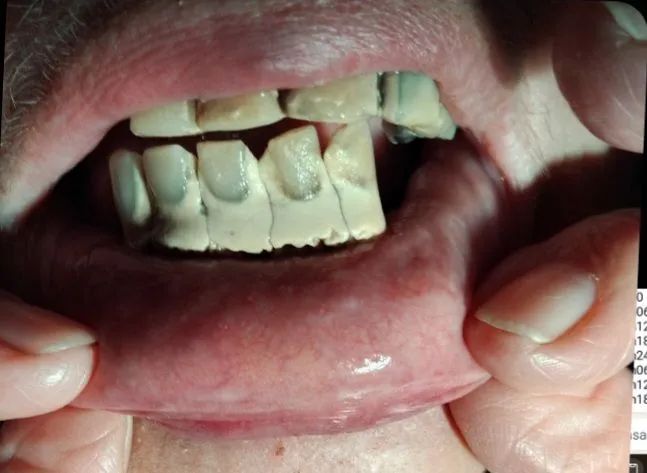 Dentista próximo da Estação de Metrô Eng Rubens Paiva  - Foto 4