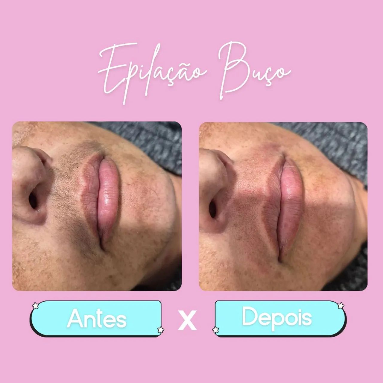 Designer de Sobrancelhas  - Foto 3