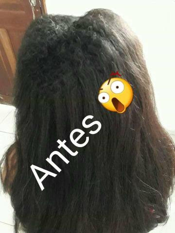 Atendimento á domicílio - Foto 2