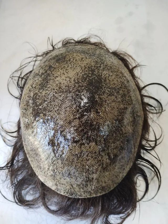 Prótese Capilar Cabelos Humano Brasileiro em Micropele  - Foto 4