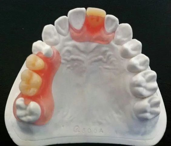 Serviços de protético  - Foto 2