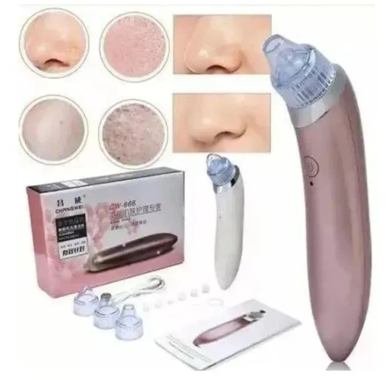 Removedor de acnes noco - Foto 5