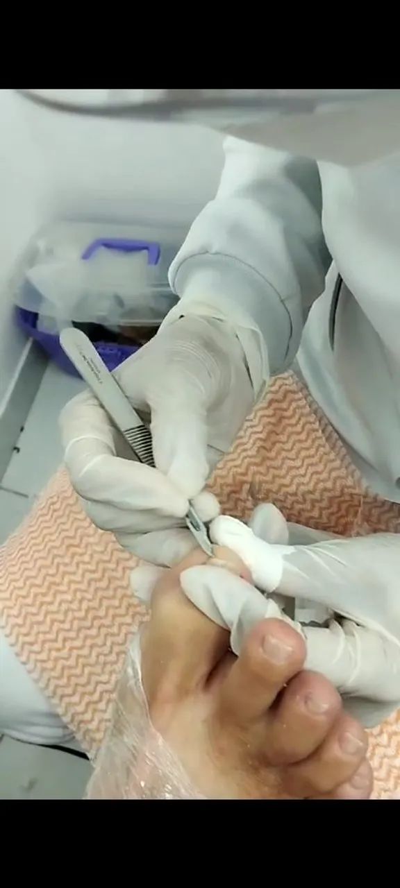 Cuidado com pés!  - Foto 3