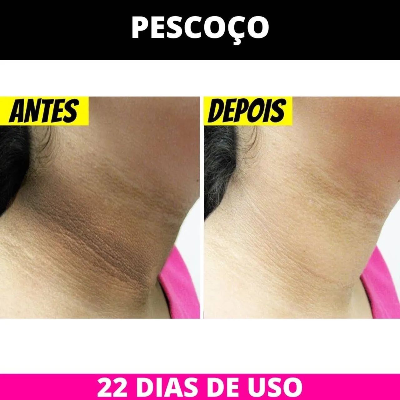 Clareador Amazole! Últimas Unidades! - Foto 2