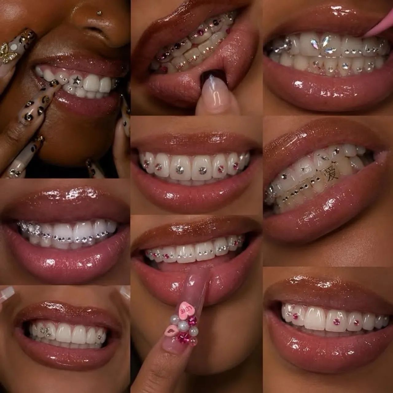 Piercing dental 50,00 - Foto 2