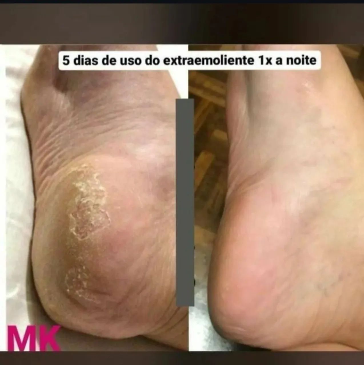 Hidratante Extramoliente noturno  - Foto 2