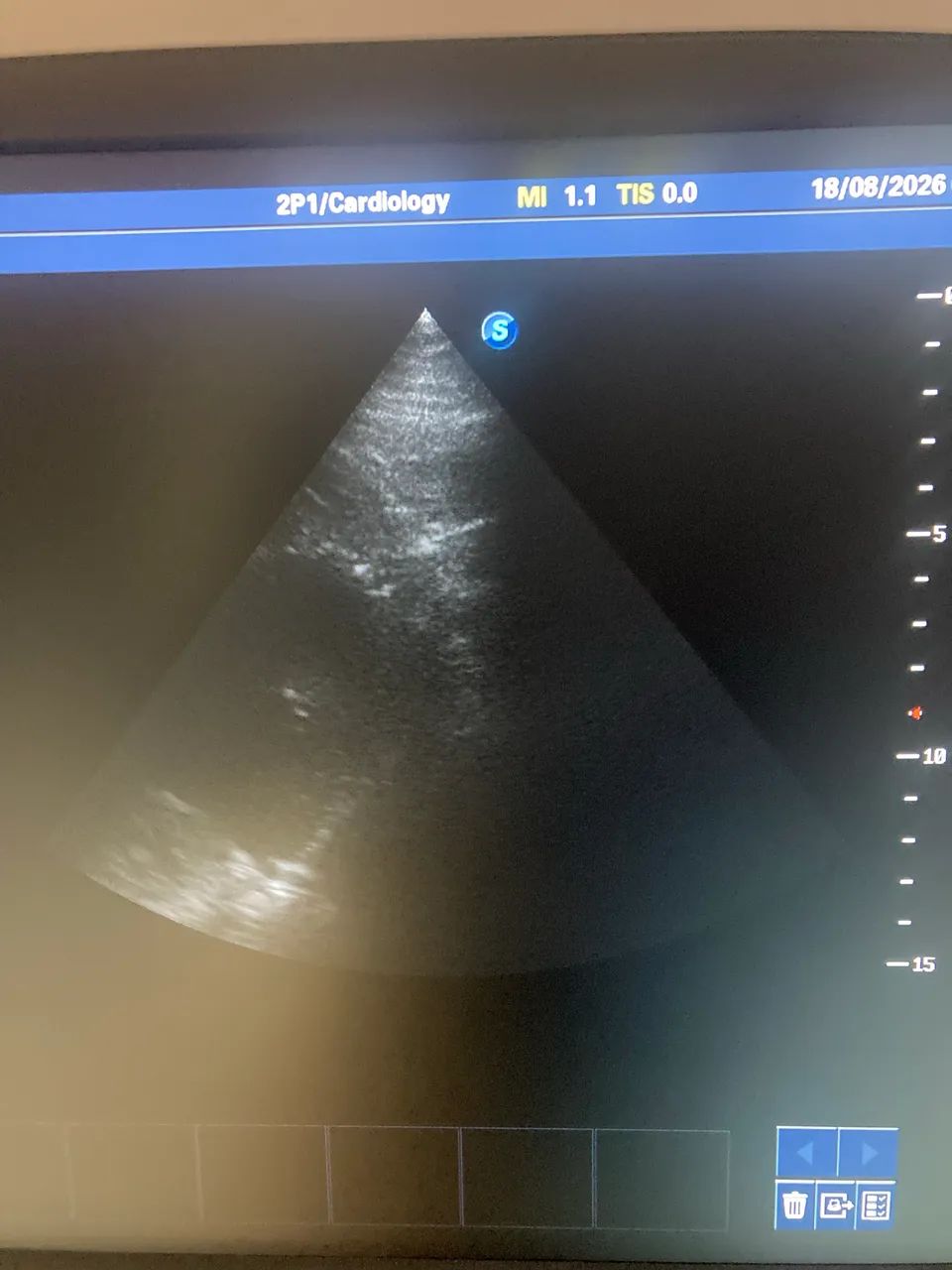 US SAEVO COM TRANSDUTOR CARDIO E VASCULAR - Foto 4