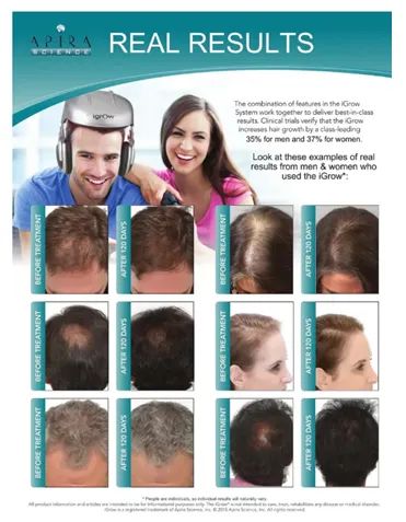 Capacete de terapia para crescimento do cabelo - Foto 5