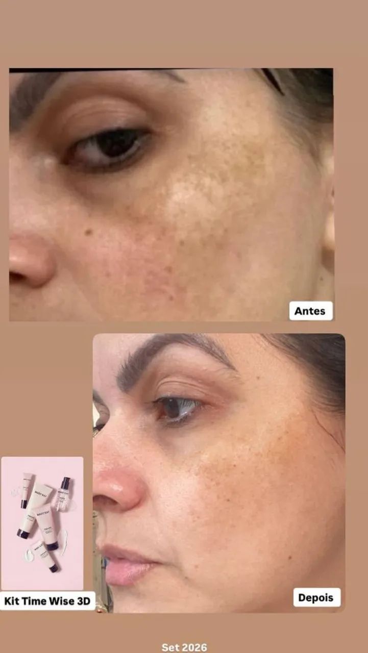 Kit timewise 3D da Mary Kay 