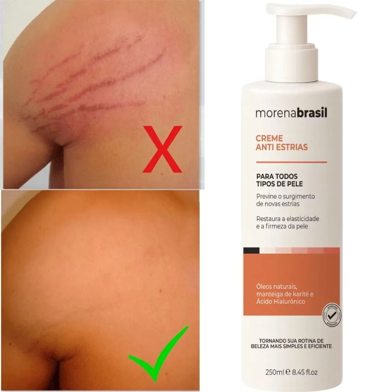 Creme AntiEstrias Morena Brasil - Foto 3