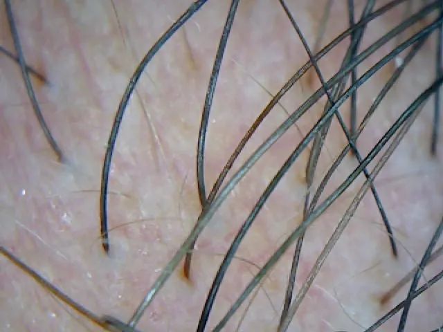 TRICOSCOPIO WIFE  - Foto 2