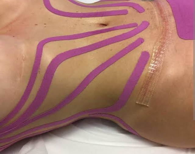 Fisioterapia Domiciliar  - Foto 3