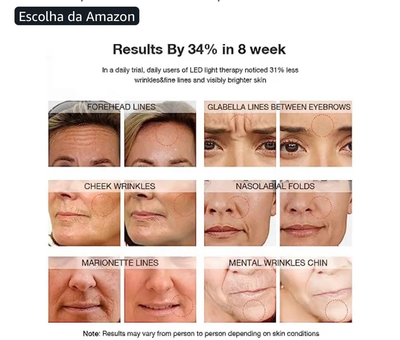 Máscara facial com Leds da Newkey  - Foto 3