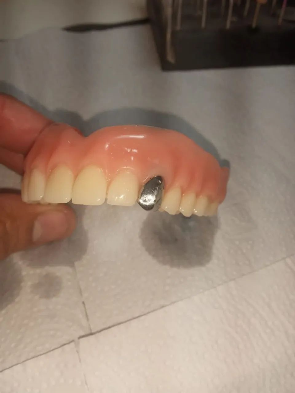 Prótese Dentária  - Foto 3