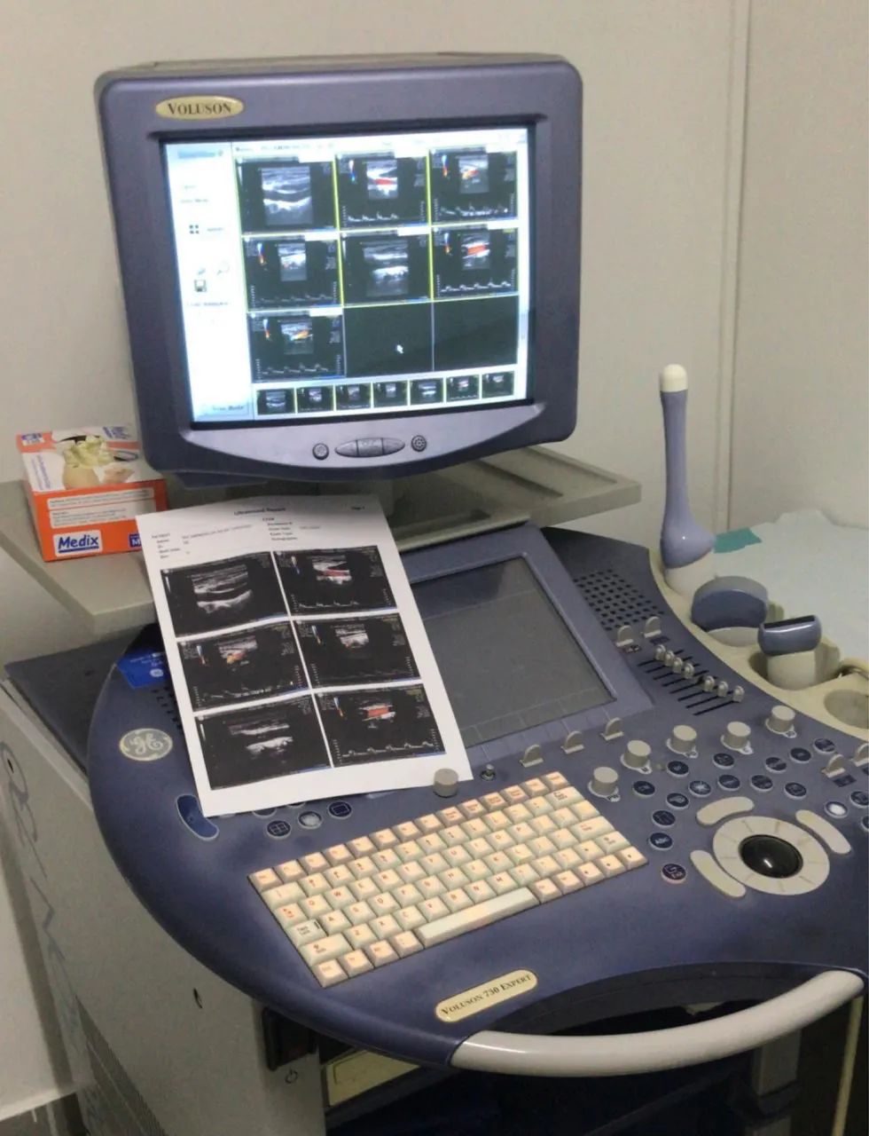 Voluson Expert 730 - Foto 3