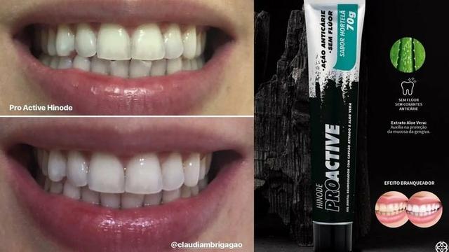 Clareador dental