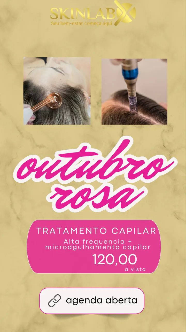 Remoção de tatuagem  - Foto 3