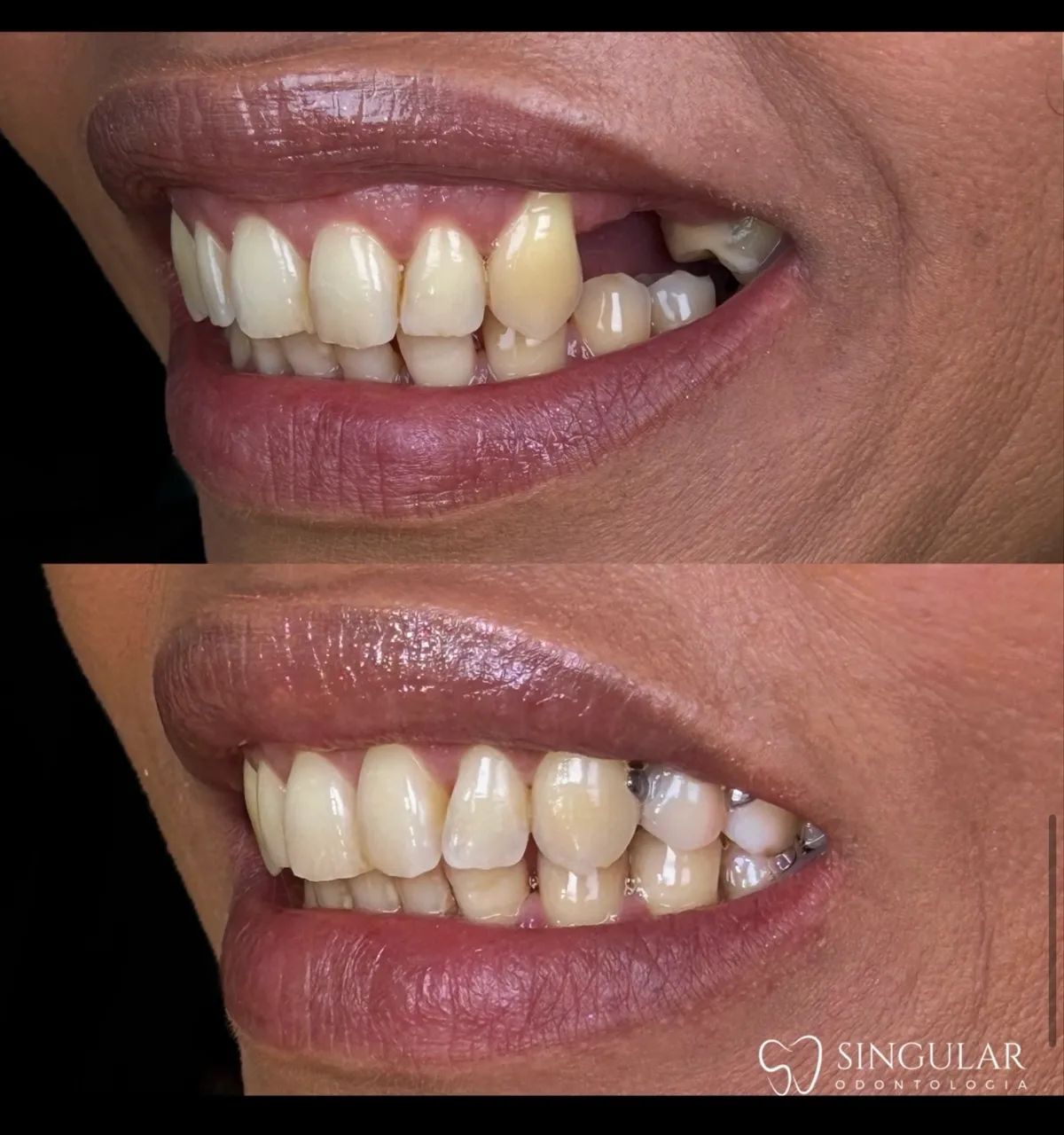 UM SORRISO SAUDÁVEL, BONITO E CUIDADO EM CADA DETALHE. - Foto 2