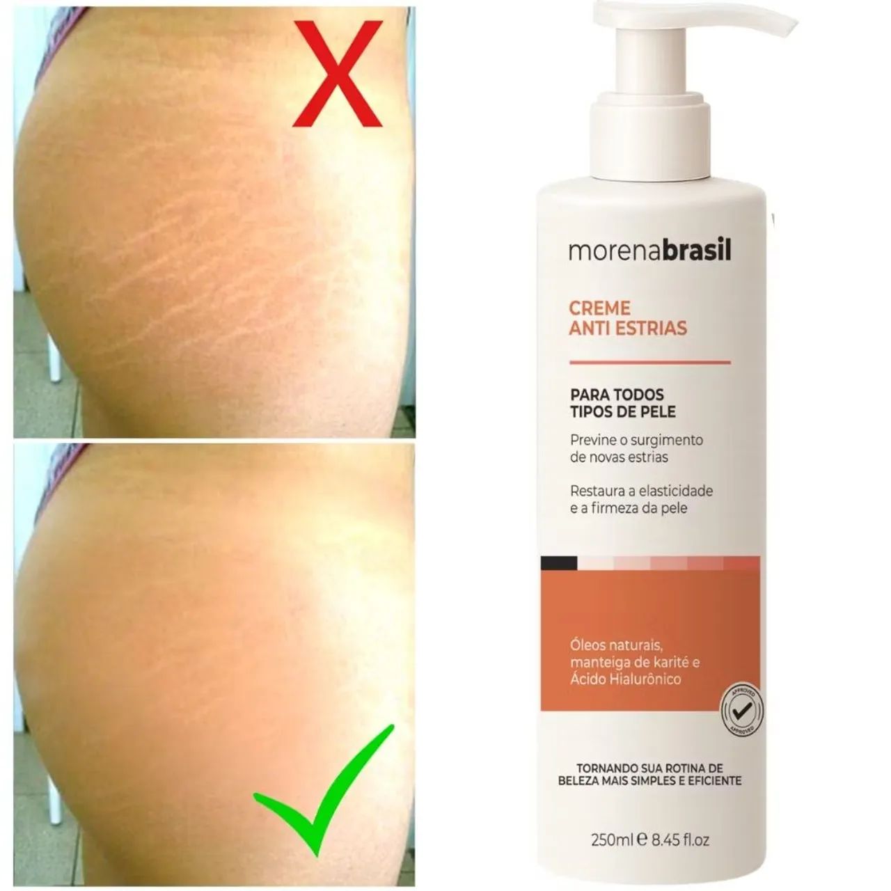 Creme AntiEstrias Morena Brasil - Foto 4