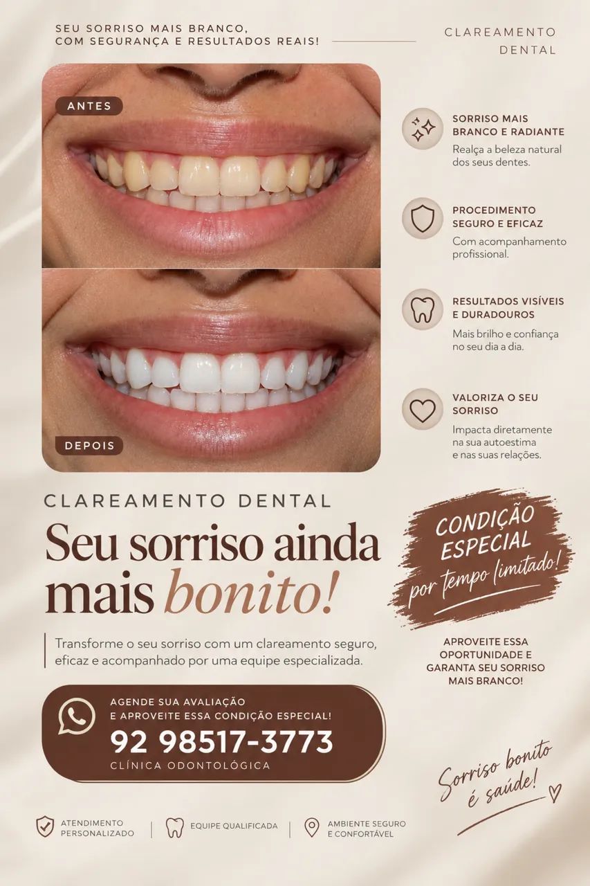 Clareamento dental em consultório 