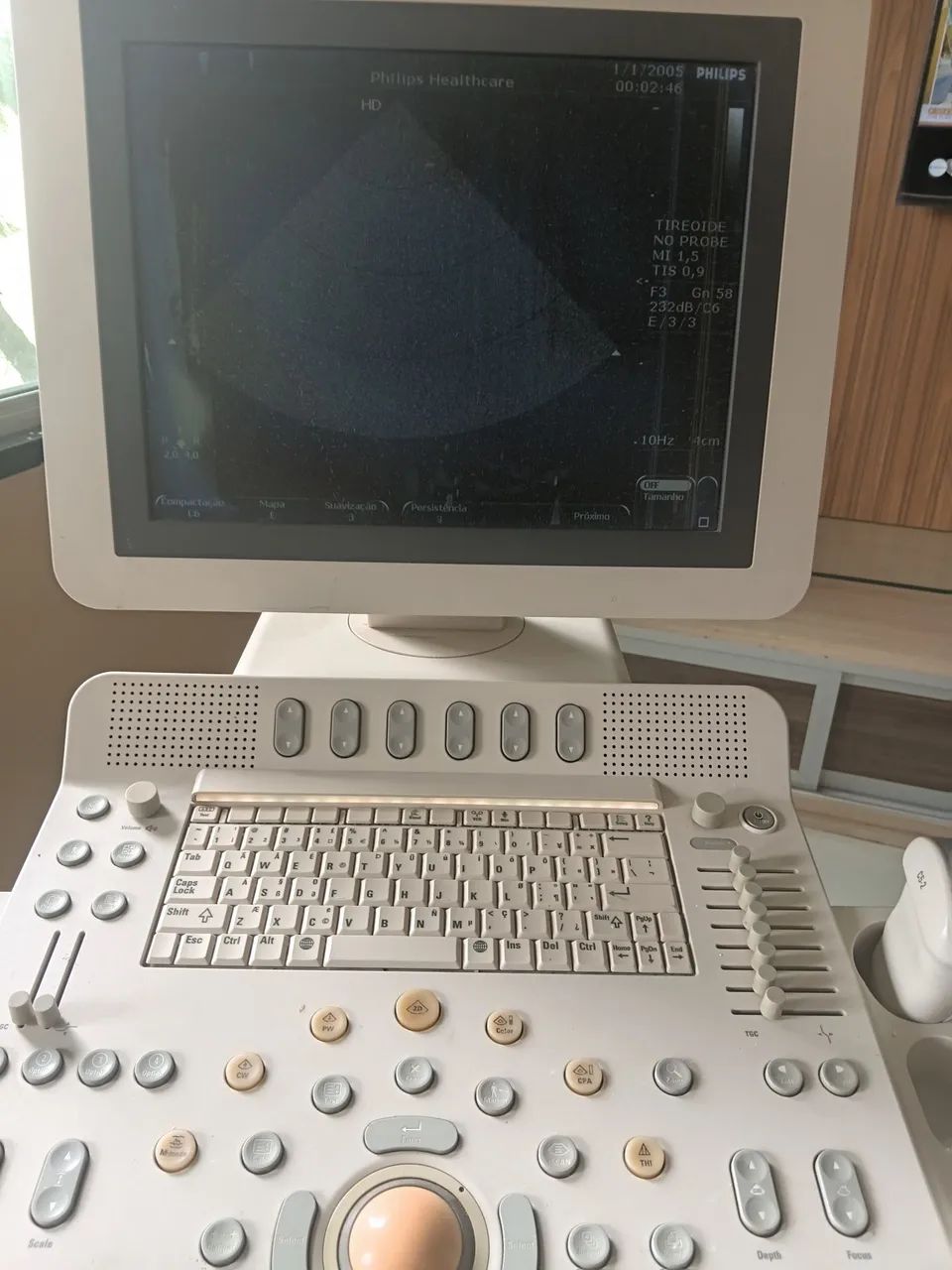 Ultrassom philips HD7  - Foto 3