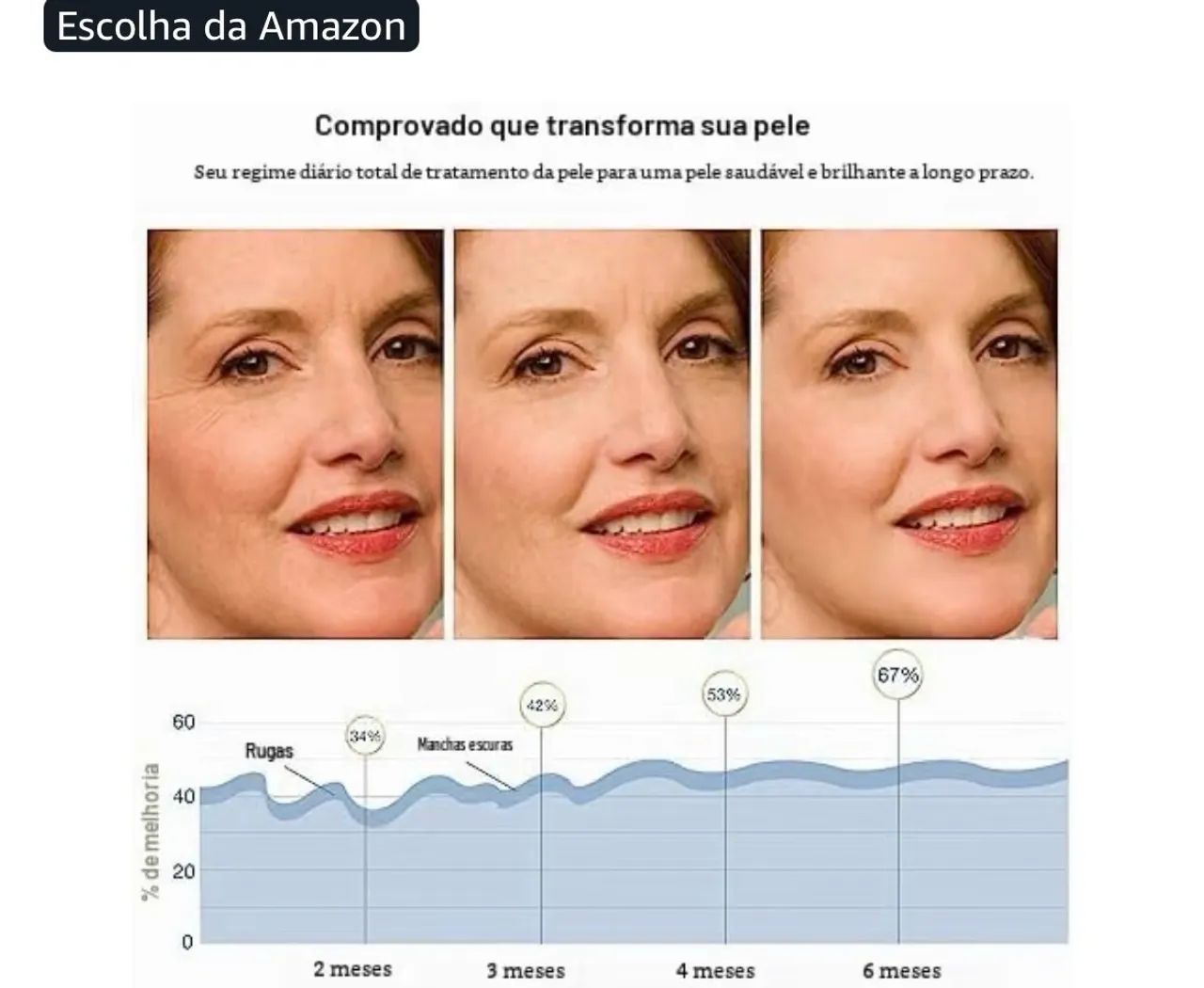 Máscara facial com Leds da Newkey  - Foto 4