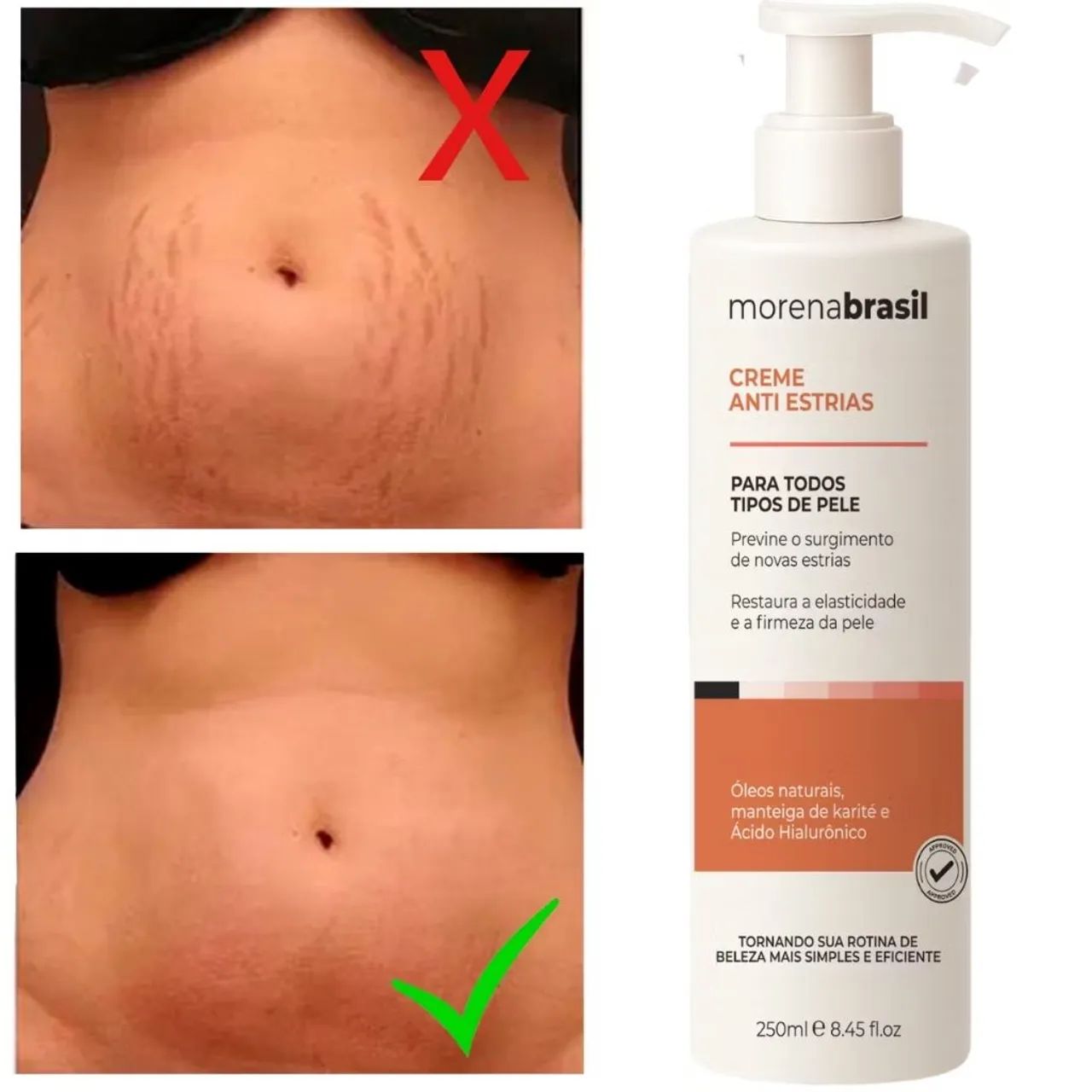 Creme AntiEstrias Morena Brasil - Foto 5