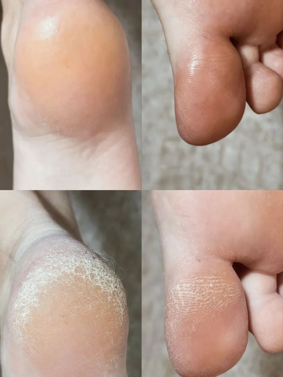 Spa dos Pés Unissex -MANICURE E PEDICURE  - Foto 3