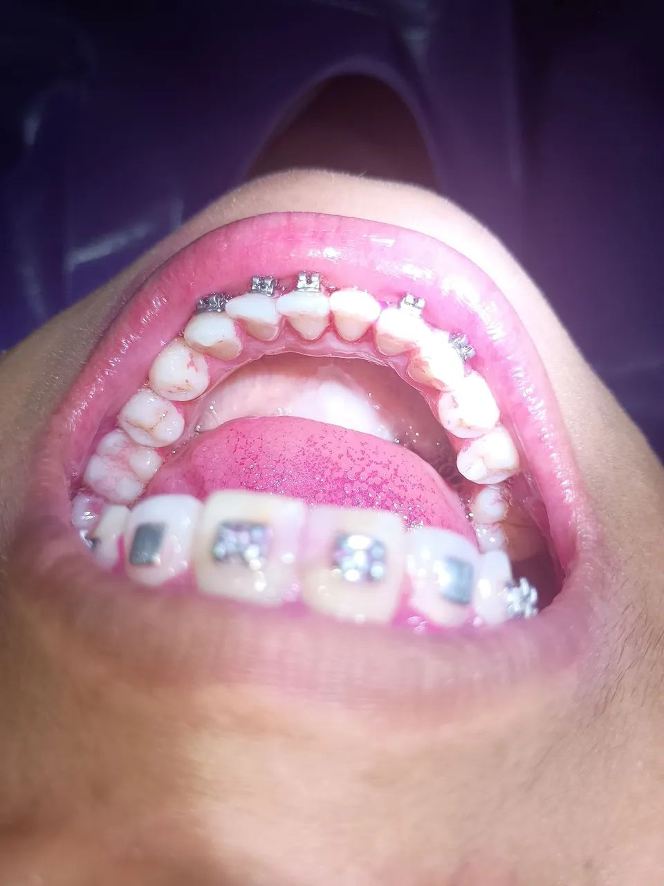 Paciente para odontologia  - Foto 2