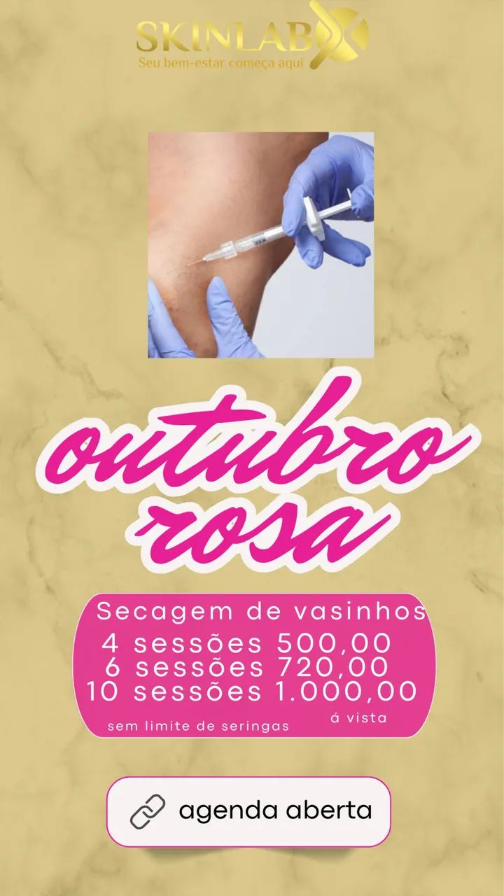 Remoção de tatuagem  - Foto 4