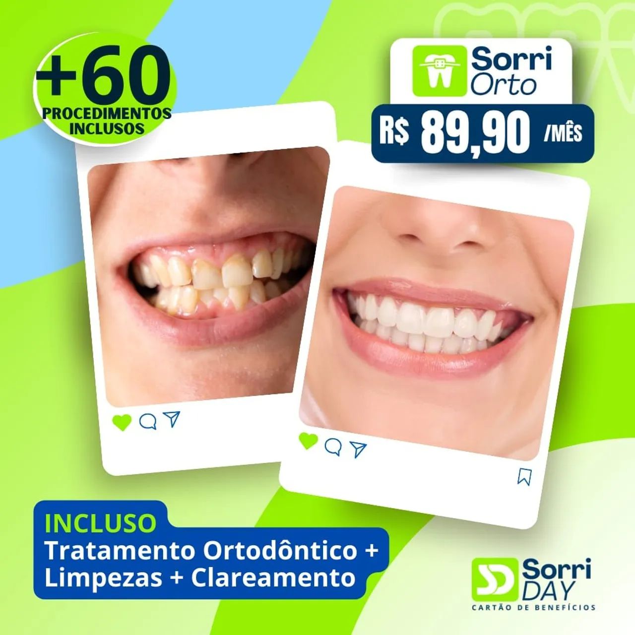 Aparelho Ortodôntico - SorriDay - Foto 3