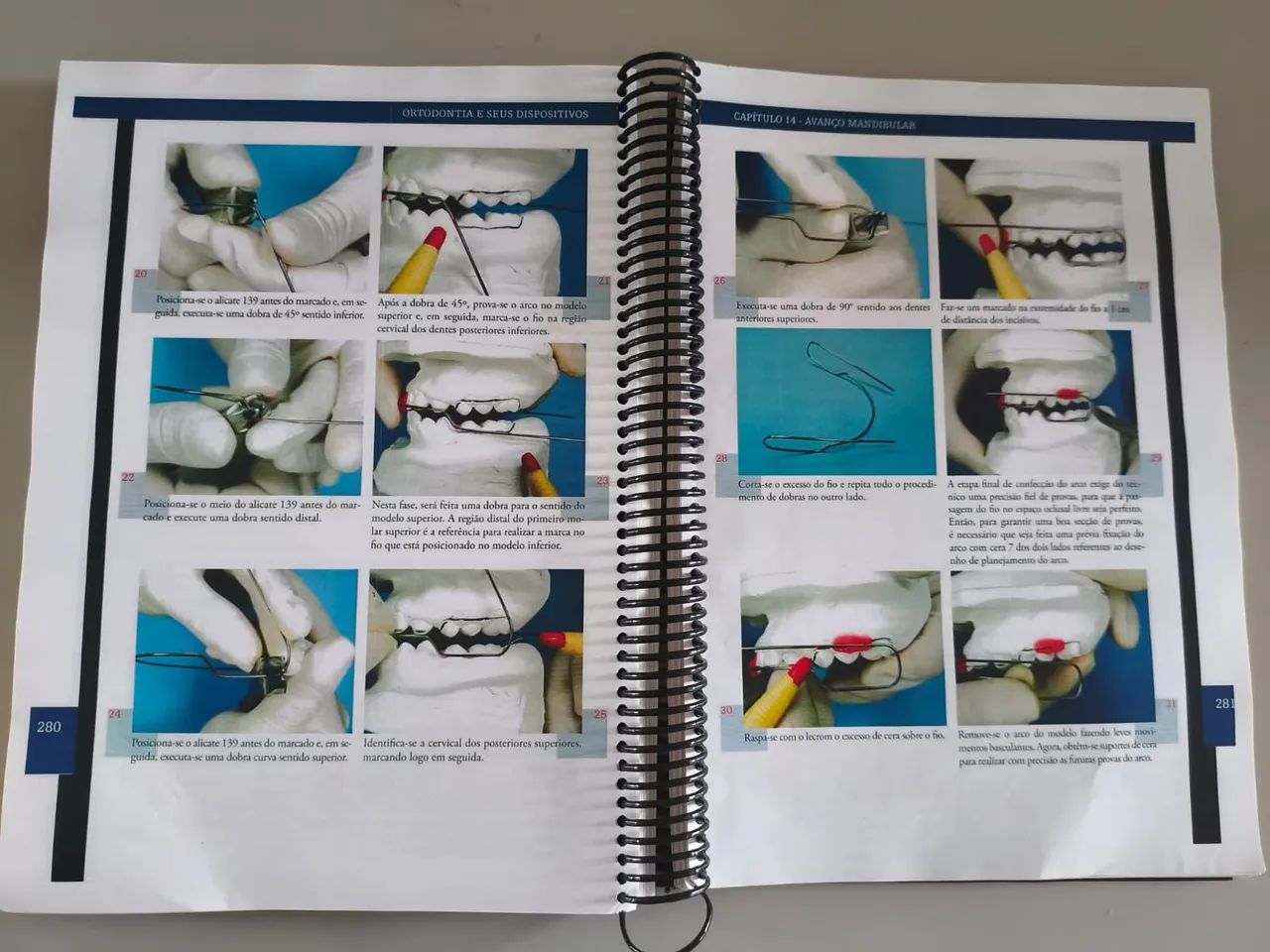 Livro ortodontia e seus dispositivos  - Foto 5