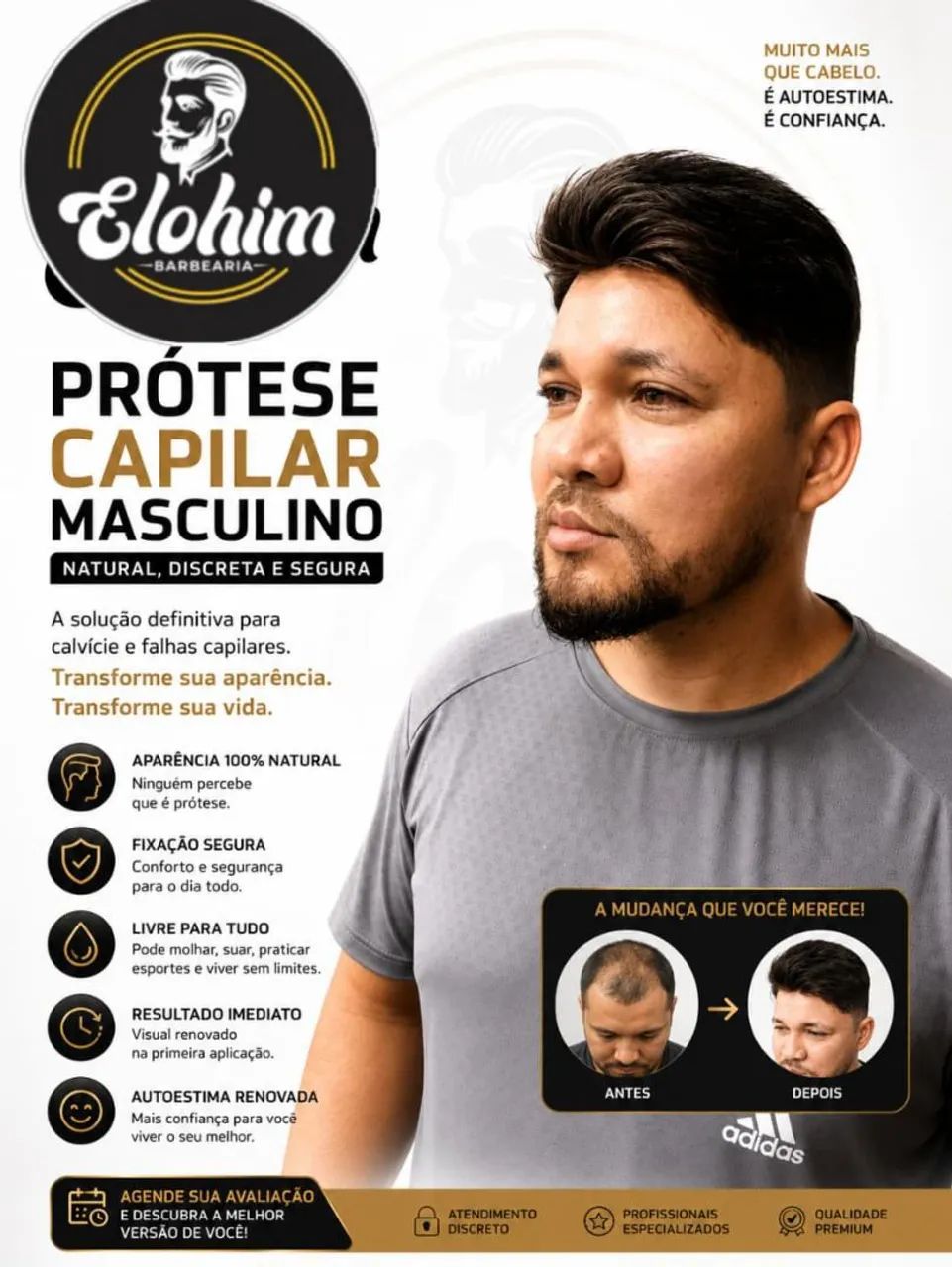 prótese capilar ' - Foto 5