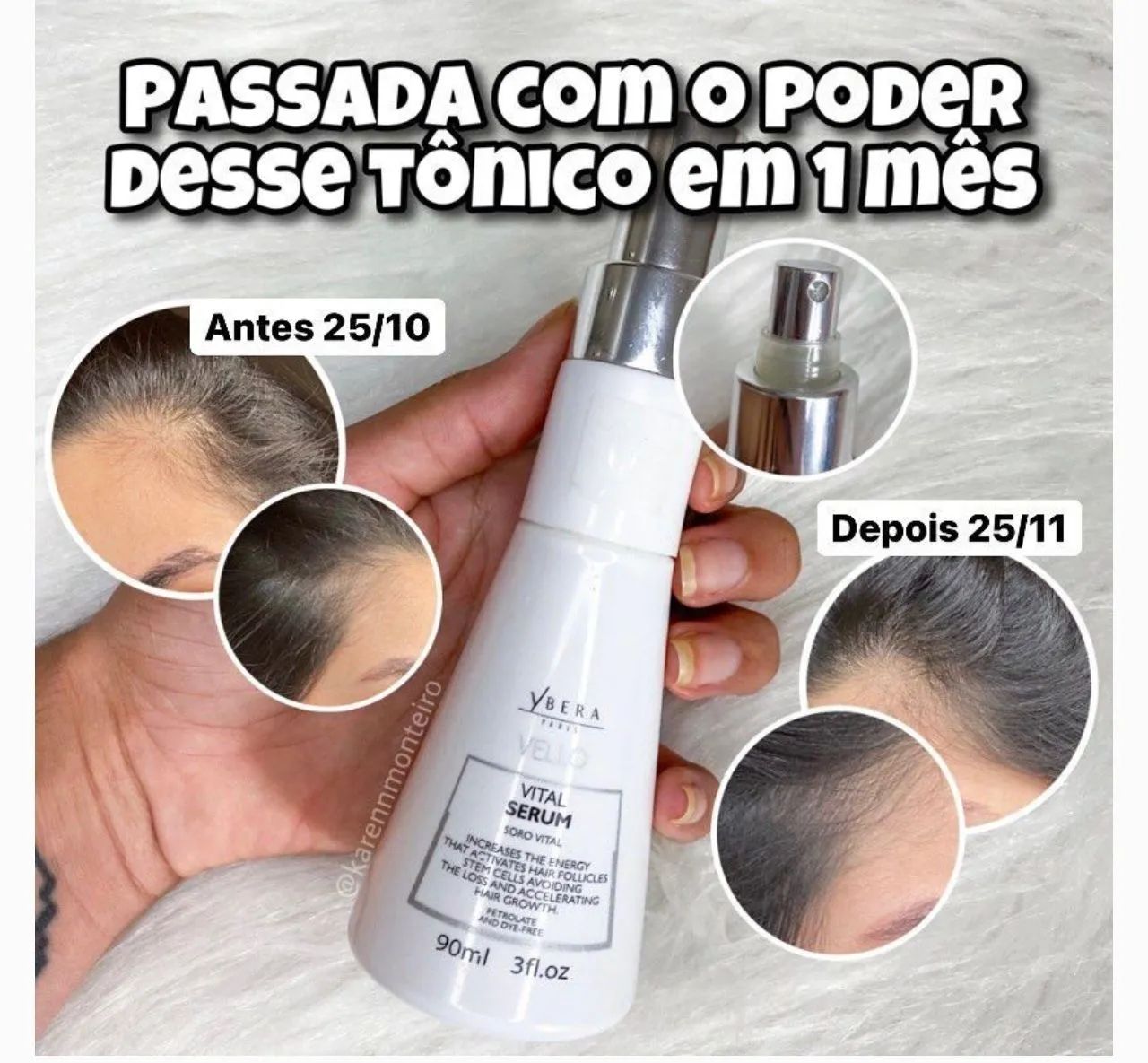 Tônico Vital Vello Crescimento Capilar Ybera - Foto 4