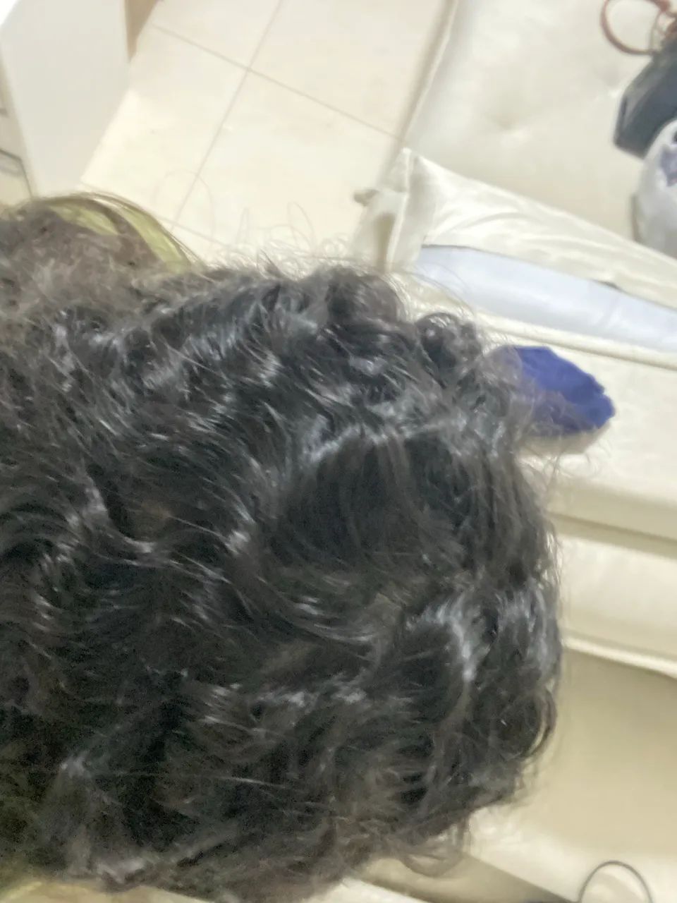 Você sofre com queda de cabelo? - Foto 2