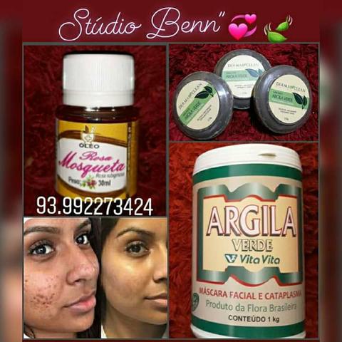 Tratamento de ACNE