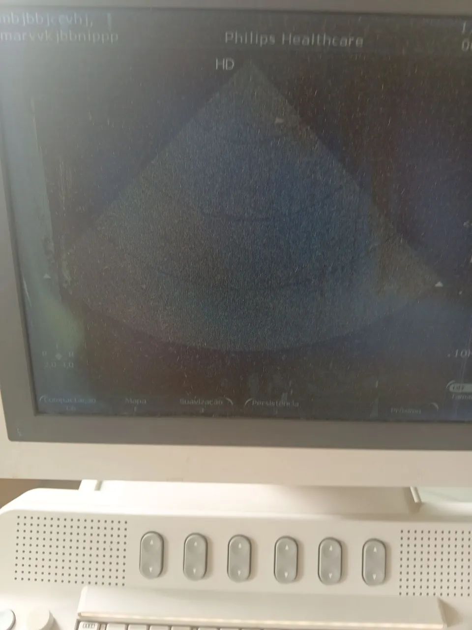Ultrassom philips HD7  - Foto 4
