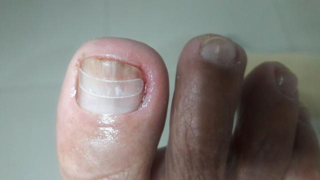 Podologa Podo Pé! cuidados da saúde dos seus pés! - Foto 3