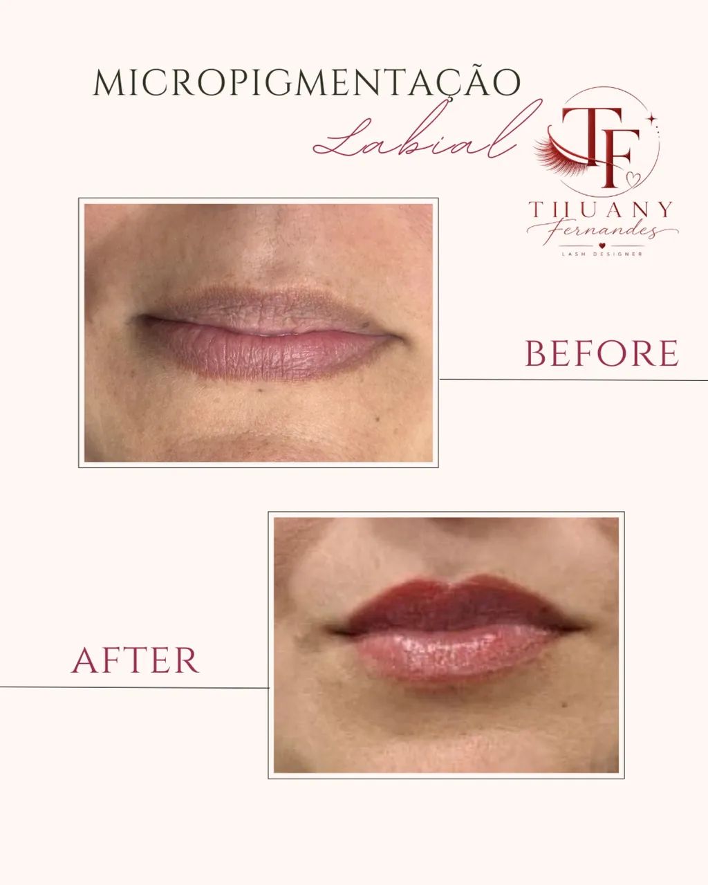 Micropigmentação labial  - Foto 3