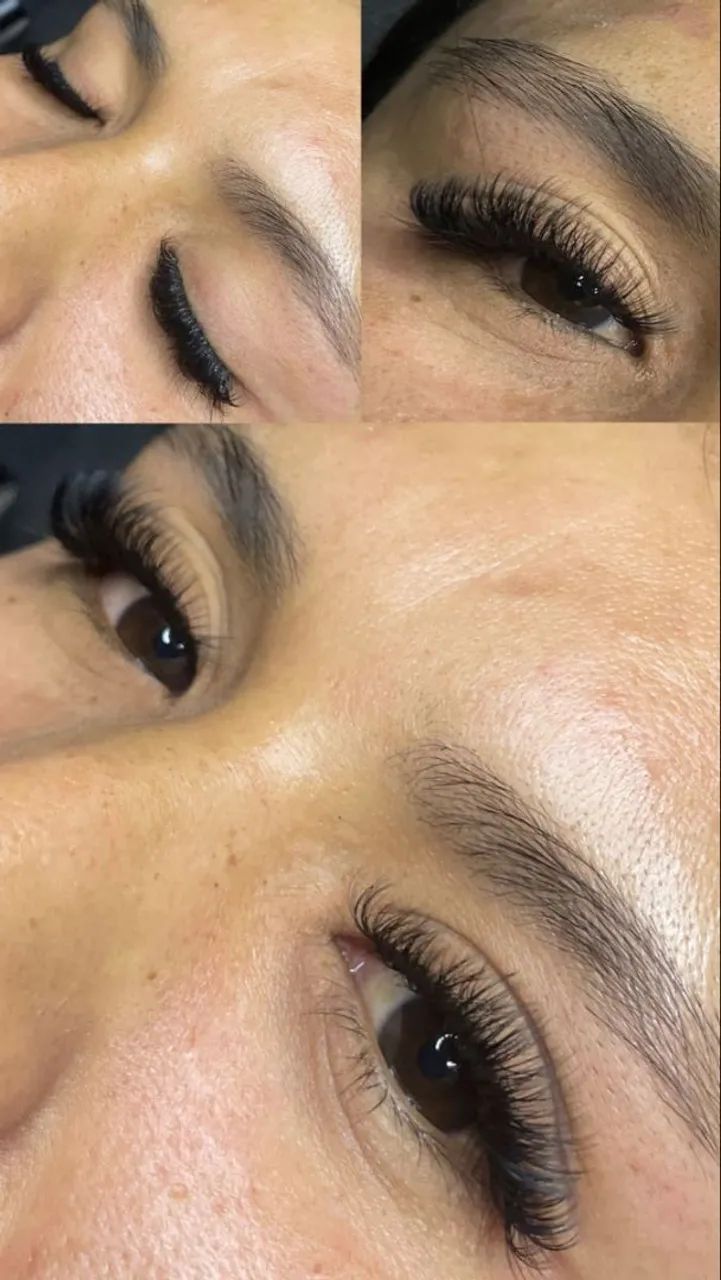 Beleza e autoestima  - Foto 4