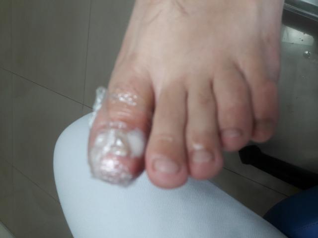 Podologa Podo Pé! cuidados da saúde dos seus pés!